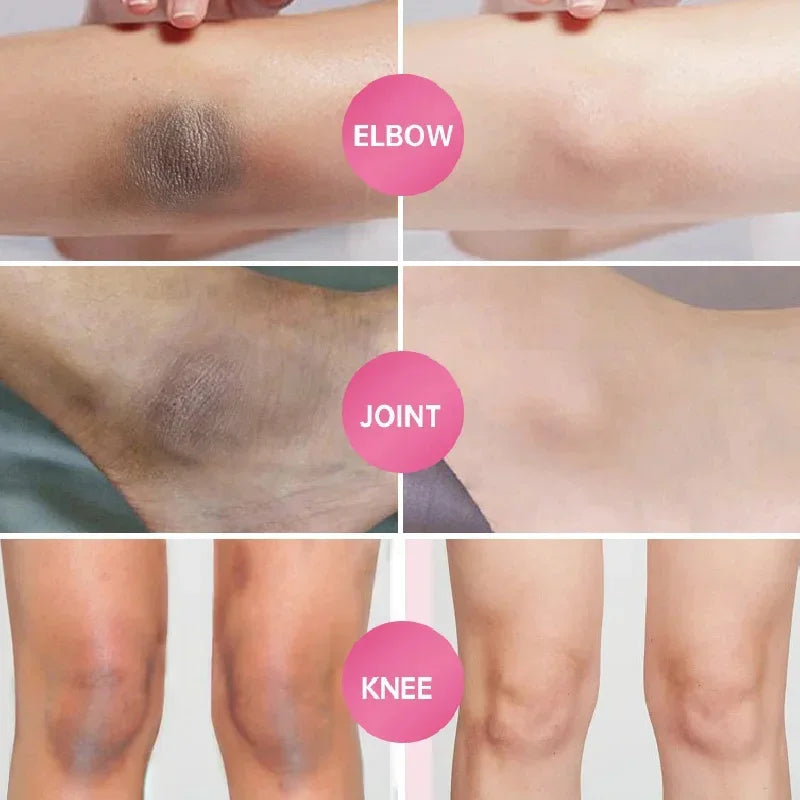 Body Whitening Soap – Brightening & Intimate Care