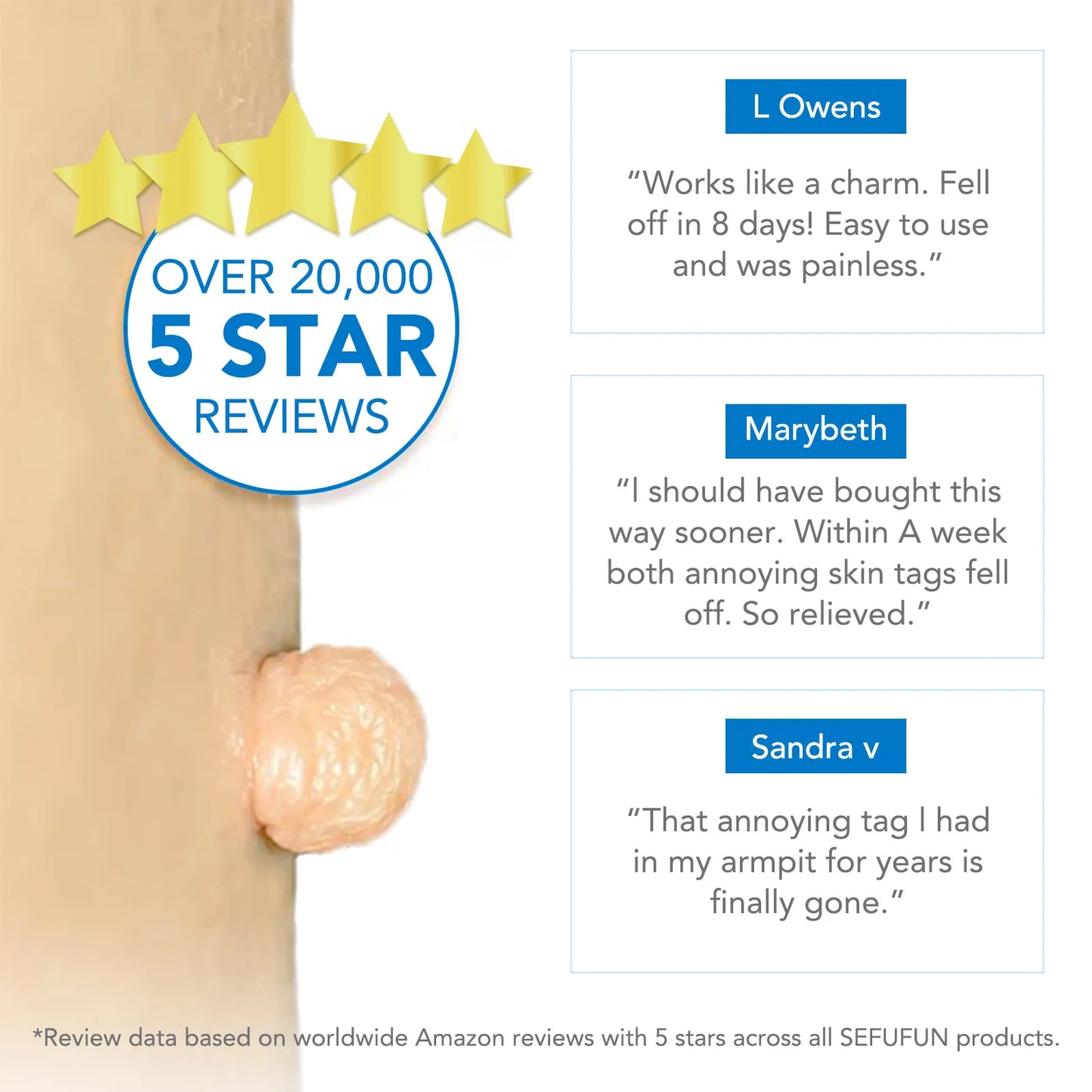 Skin Tag Removal Kit – Safe & Effective for 2–8mm Skin Tags