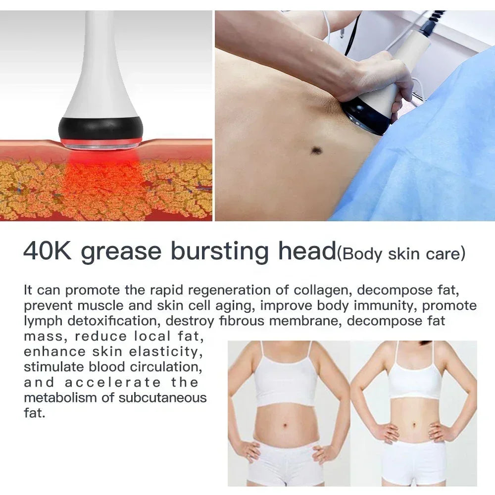 40K Ultrasonic Cavitation & RF Machine – Body Slimming & Facial Lifting