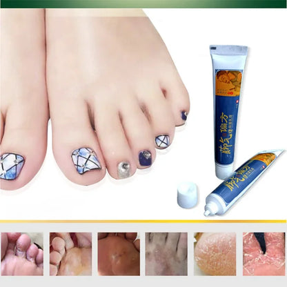Foot Anti-Fungus Cream – Itch Relief & Moisturizing Care