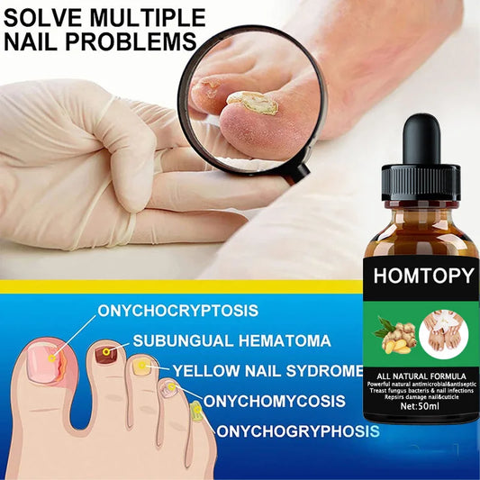 7 Days Nail Fungus Treatment Oil – Anti-Fungal Repair Serum
