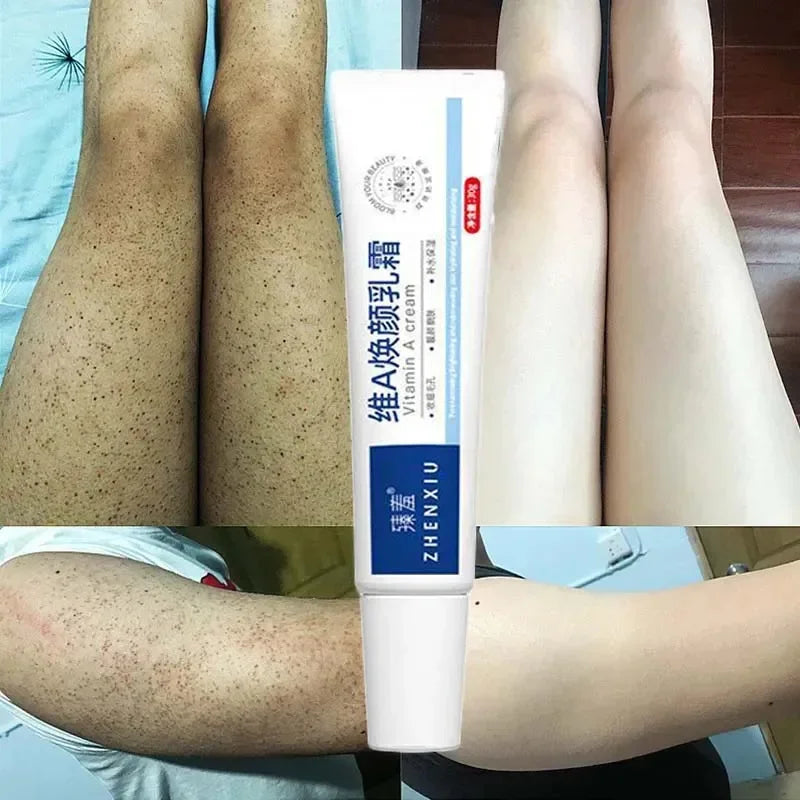 Body Whitening Cream – Keratosis Pilaris & Strawberry Legs Treatment