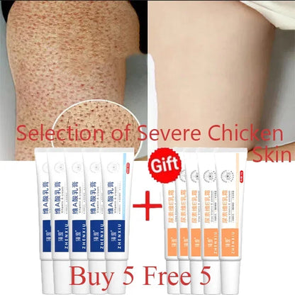 Body Whitening Cream – Keratosis Pilaris & Strawberry Legs Treatment