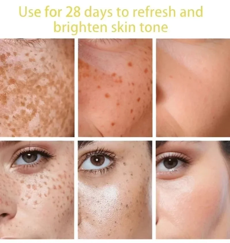 Dark Spot Remover Serum – Anti-Pigmentation & Skin Brightening