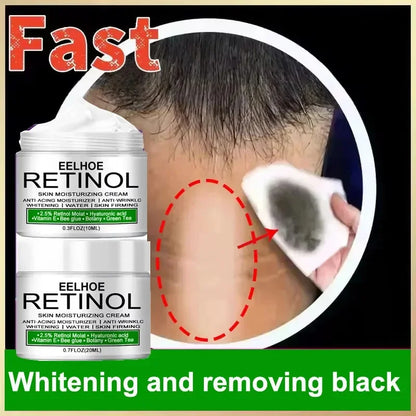 Body Whitening Cream – Intimate & Underarm Lightening