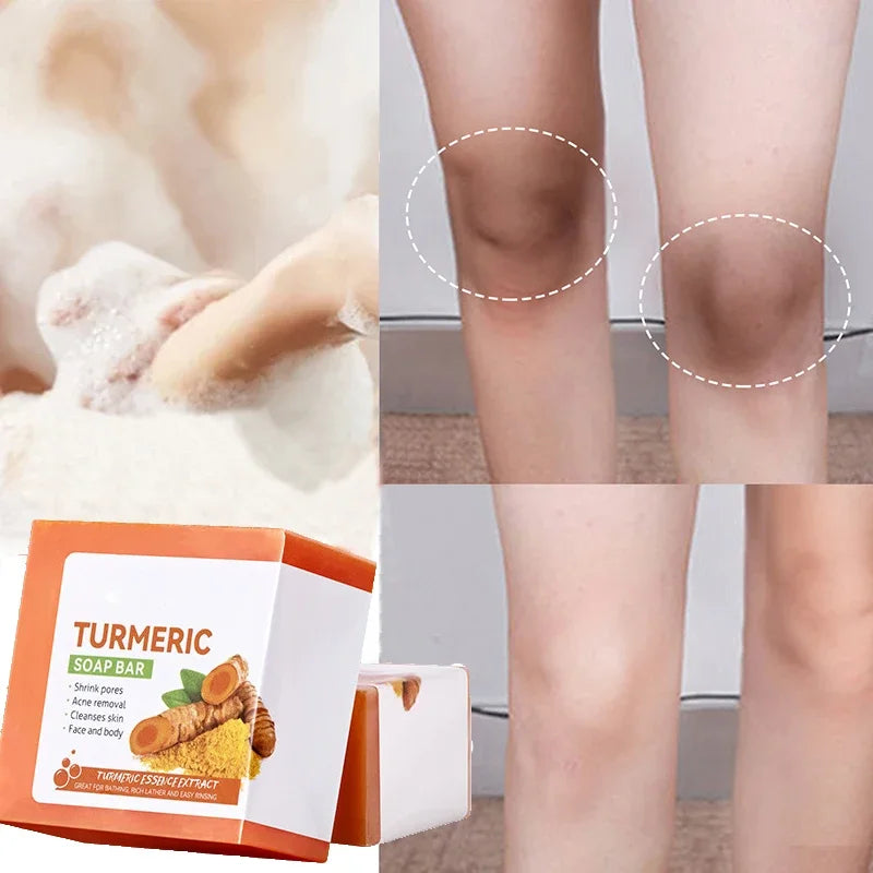 Handmade Turmeric Soap – Skin Brightening & Deep Cleansing Bar