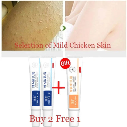 Body Whitening Cream – Keratosis Pilaris & Strawberry Legs Treatment