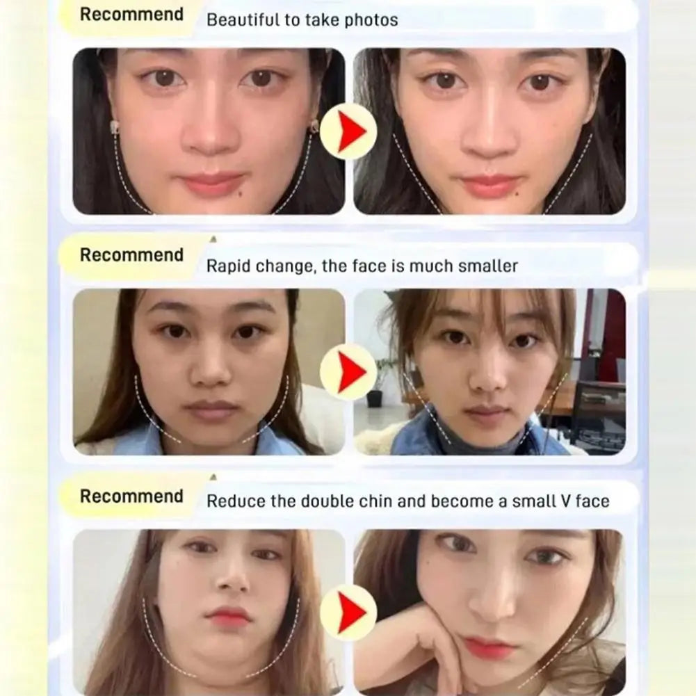 Chin Up V-Line Face Shaping Mask – Slimming & Lifting Facial Sleep Strap