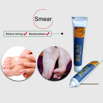 Foot Anti-Fungus Cream – Itch Relief & Moisturizing Care