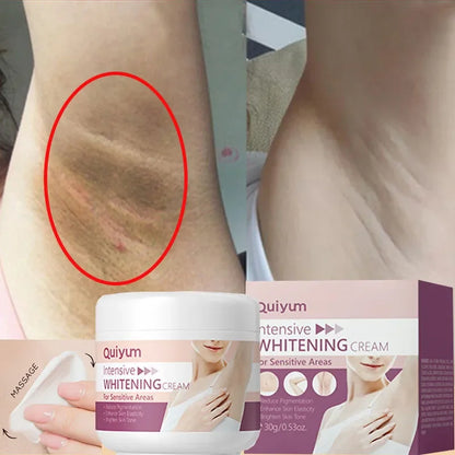Whitening Cream – Underarm & Intimate Lightening