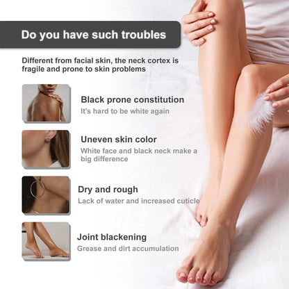 Body Whitening Bleach Cream – Dark Spot Remover