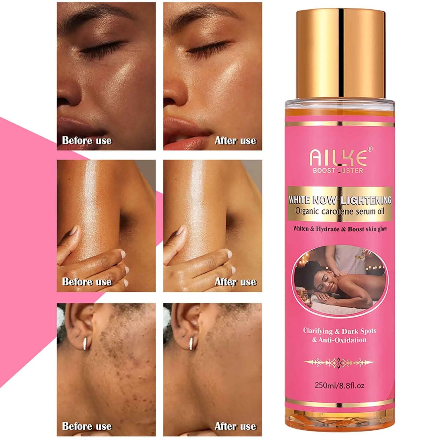 AILKE Carotene Brightening Body Oil: Vitamin E, Rose Oil, Smooth Skin