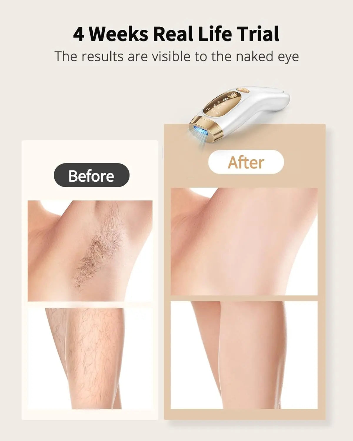 IPL Hair Removal Device Unlimited Flashes – 9 Gears Painless Ice-Cooling Epilator for Men & Women Body, Bikini & Intimate