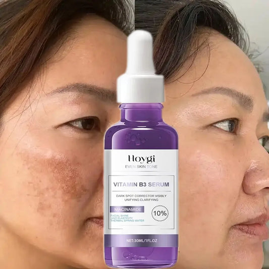 Dark Spot Remover Serum – Anti-Pigmentation & Skin Brightening