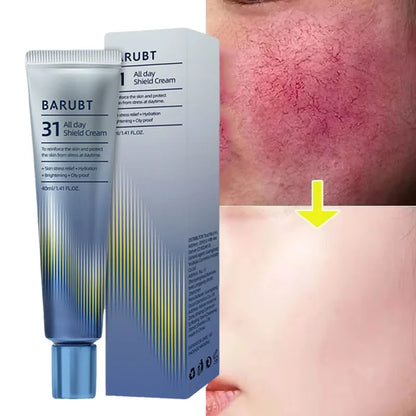 Anti-Redness Repair Cream – Rosacea & Spider Vein Treatment