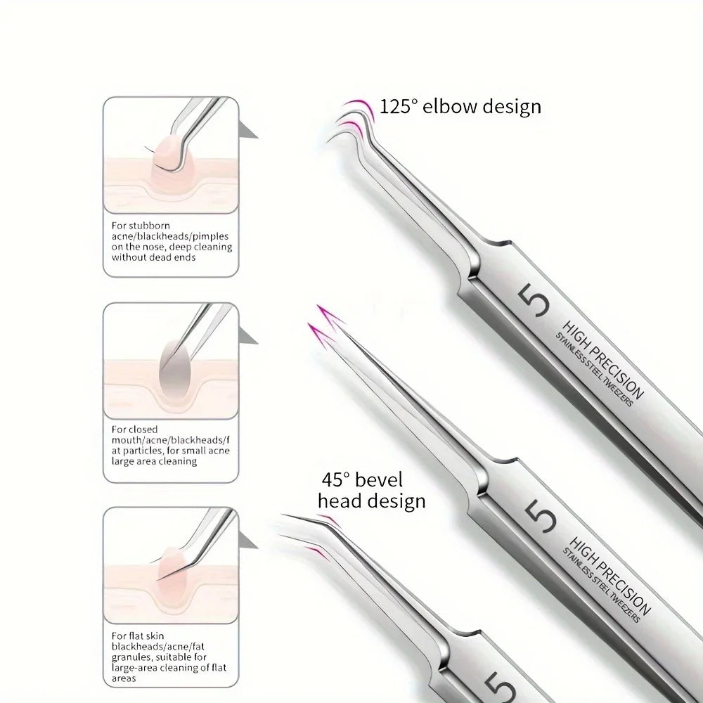 Stainless Steel Blackhead Removal Tool Set – Tweezers, Clips & Acne Needles for Facial Care