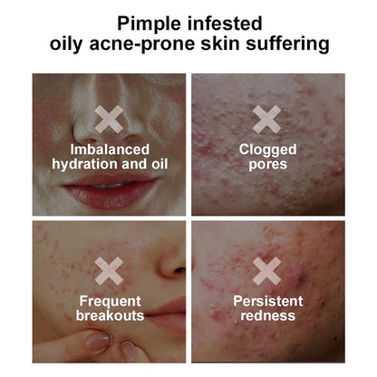 Pore Shrinking Face Cream Set – Oil Control & Skin Repair