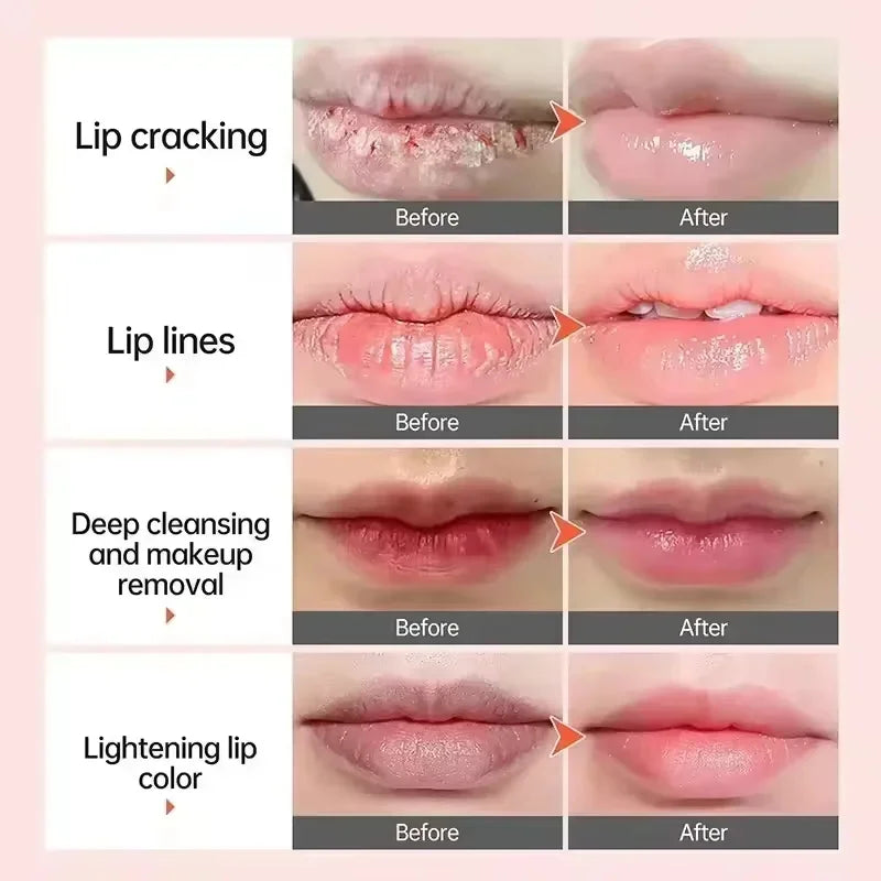 Fast Lightening Pink Lips Serum – Dark Lips Corrector, Moisturizing Lip Balm & Gloss Care