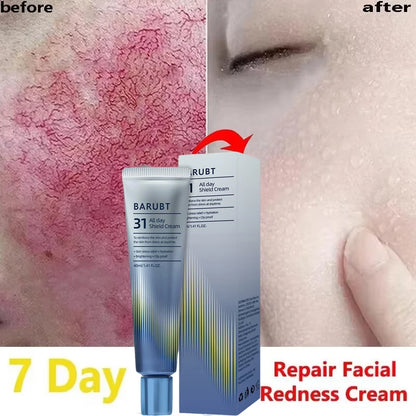 Anti-Redness Repair Cream – Rosacea & Spider Vein Treatment