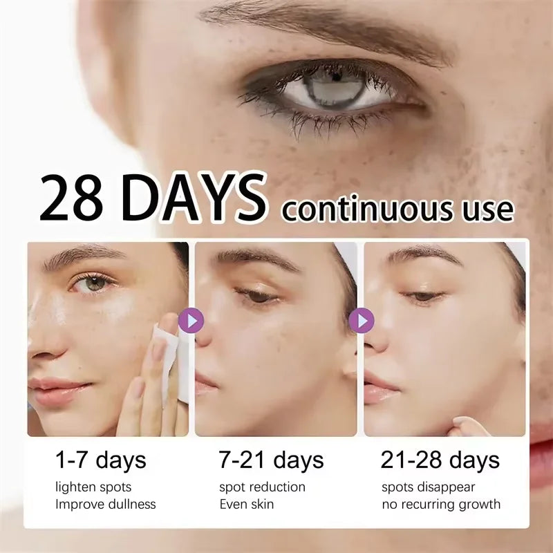 Dark Spot Remover Serum – Anti-Pigmentation & Skin Brightening