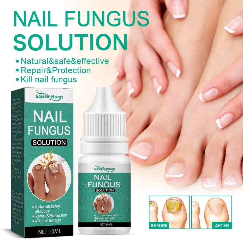 Extra Strong Nail Fungus Treatment – Toe & Nail Repair Oil