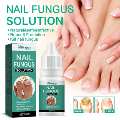 Extra Strong Nail Fungus Treatment – Toe & Nail Repair Oil