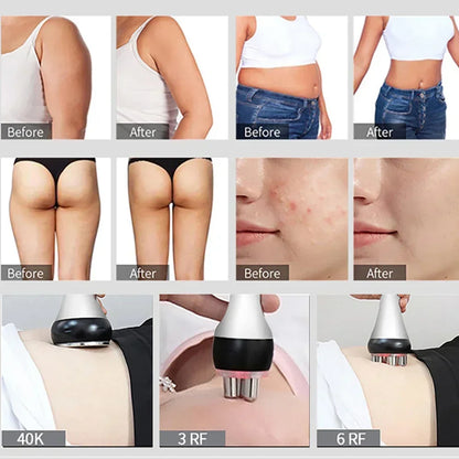 40K Ultrasonic Cavitation & RF Machine – Body Slimming & Facial Lifting