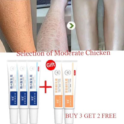 Body Whitening Cream – Keratosis Pilaris & Strawberry Legs Treatment