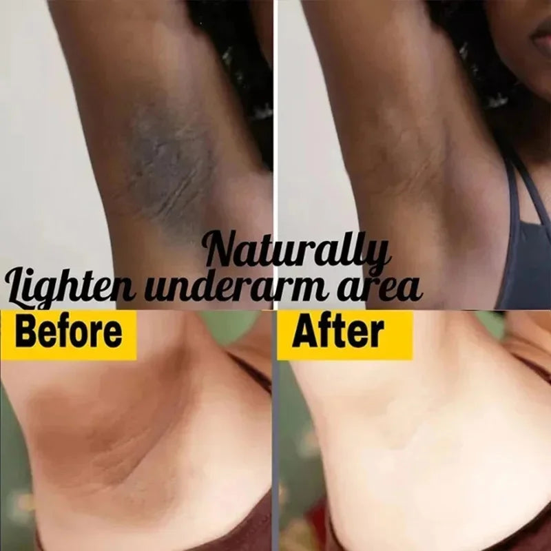 Body Whitening Soap – Brightening & Intimate Care