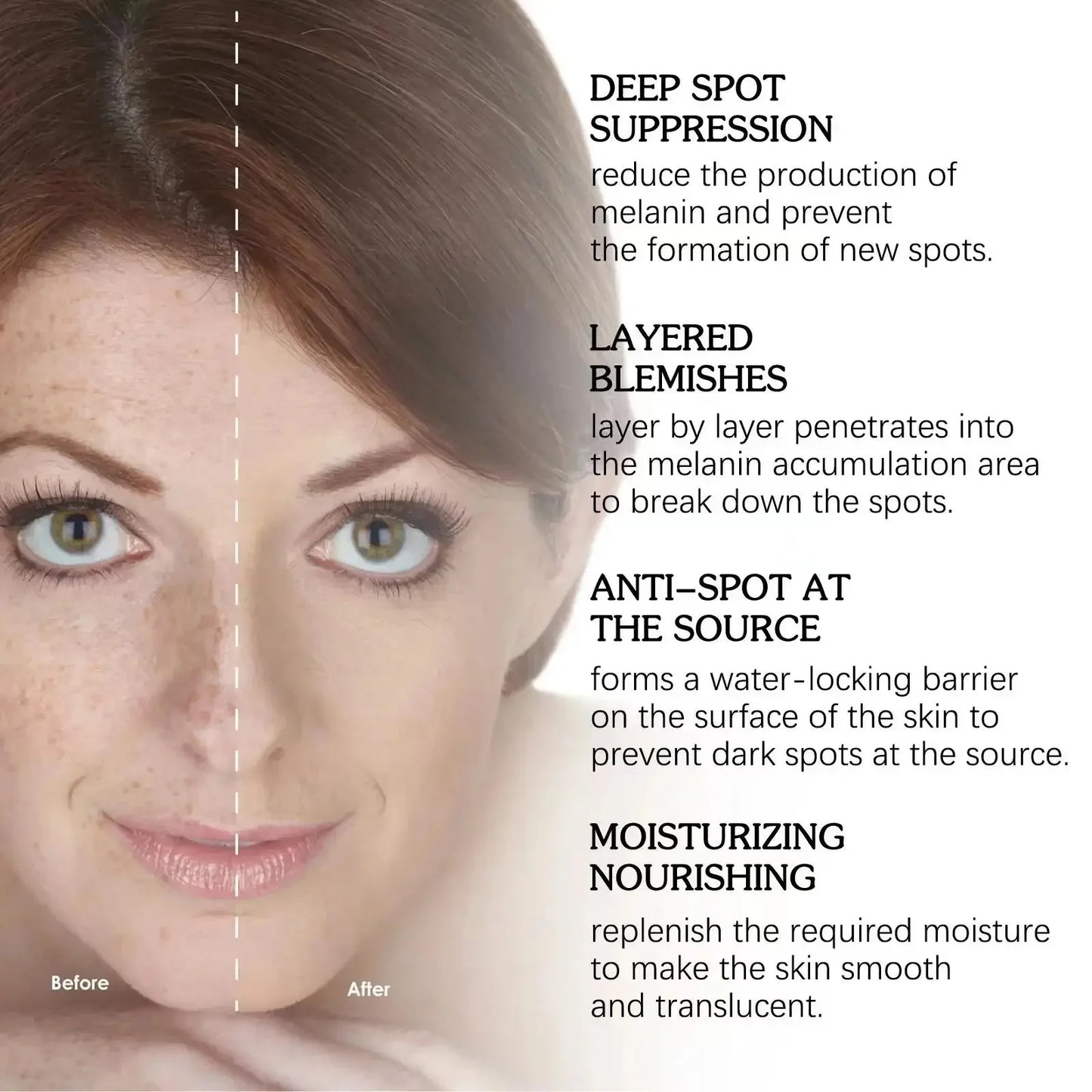 Dark Spot Remover Serum – Anti-Pigmentation & Skin Brightening