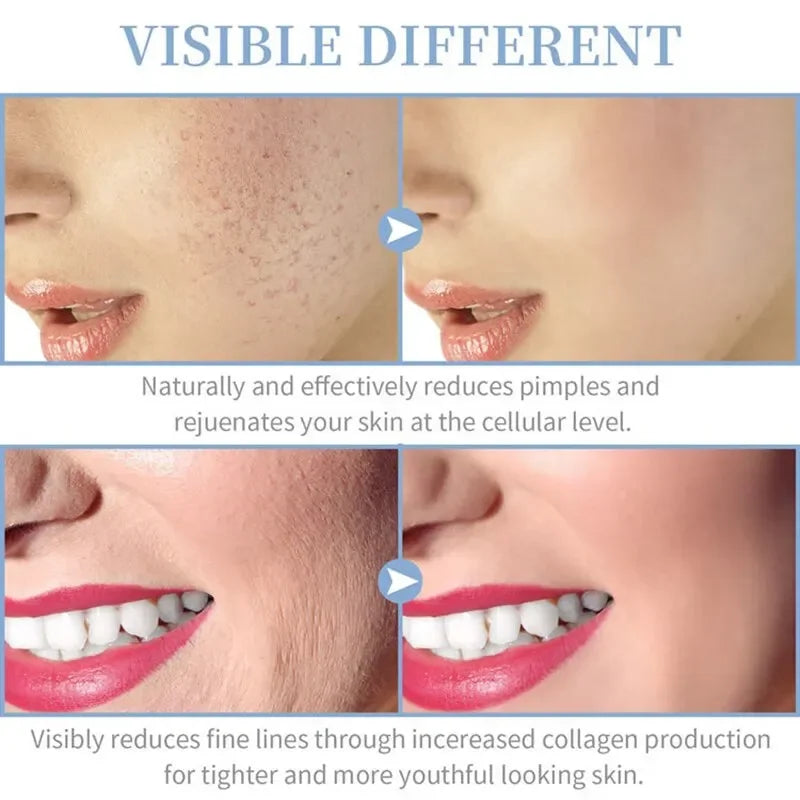 4 in 1 High Frequency Facial Wand