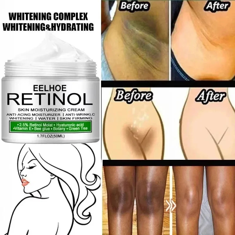 Body Whitening Cream – Intimate & Underarm Lightening