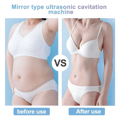 40K Ultrasonic Cavitation & RF Machine – Body Slimming & Facial Lifting