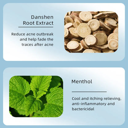 Acne Treatment Cream – Pimple Remover & Pore Minimizer