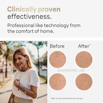 Permanent Laser Hair Removal Bikini Women's IPL Depilator & Men's Shaver