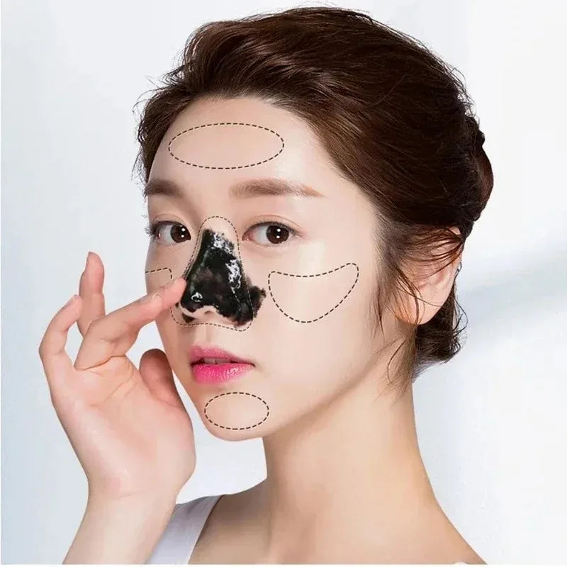 LANBENA Blackhead Remover Mask – Deep Cleansing, Pore Shrinking & Skin Brightening